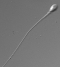 spermatozoïde normal sans vacuole 