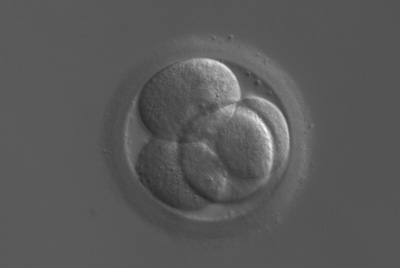 embryon J 2