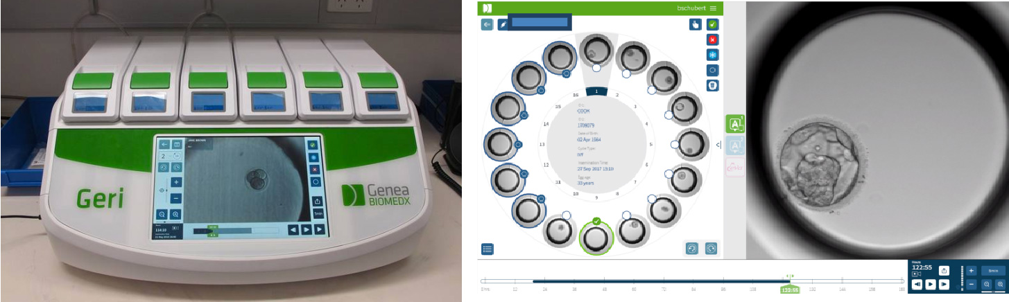 Incubateur Time Lapse
