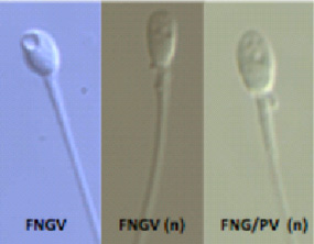 spermatozoïdes normaux avec des vacuoles.